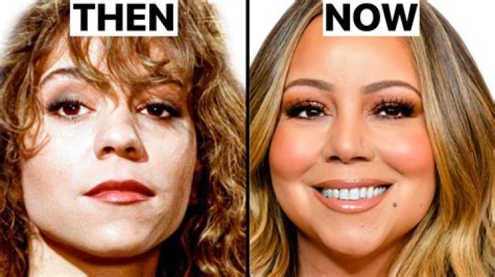 A Close Look At Mariah Carey's Plastic Surgery Transformation?