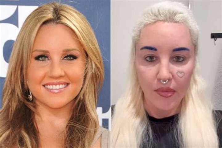 Amanda Bynes' cosmetic surgery was 'the best thing she's ever done'