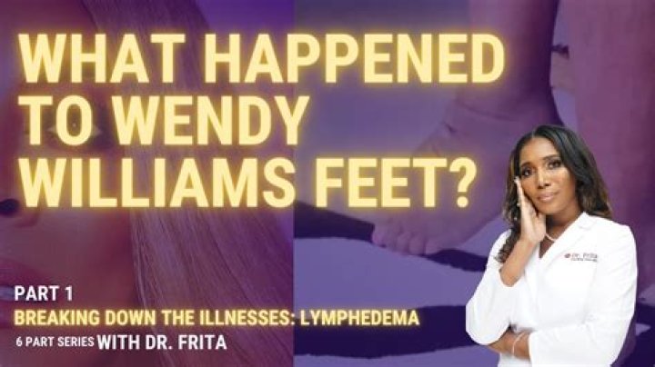 Are Wendy Williams’ Feet More Famous than Williams Herself?