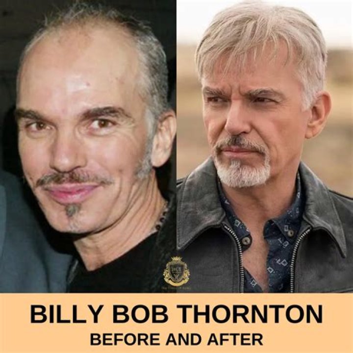 Billy Bob Thornton: weave, toupee or plugs?