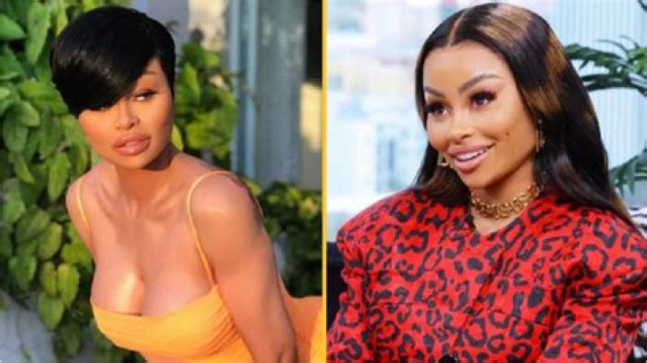 Blac Chyna Before Fillers Pictures – Plastic Surgery Details Age And Boyfriend