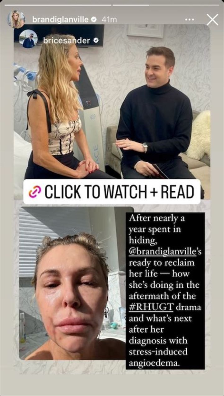 Brandi Glanville Shares That Denise Richards Offered Her A 'Public Olive Branch'