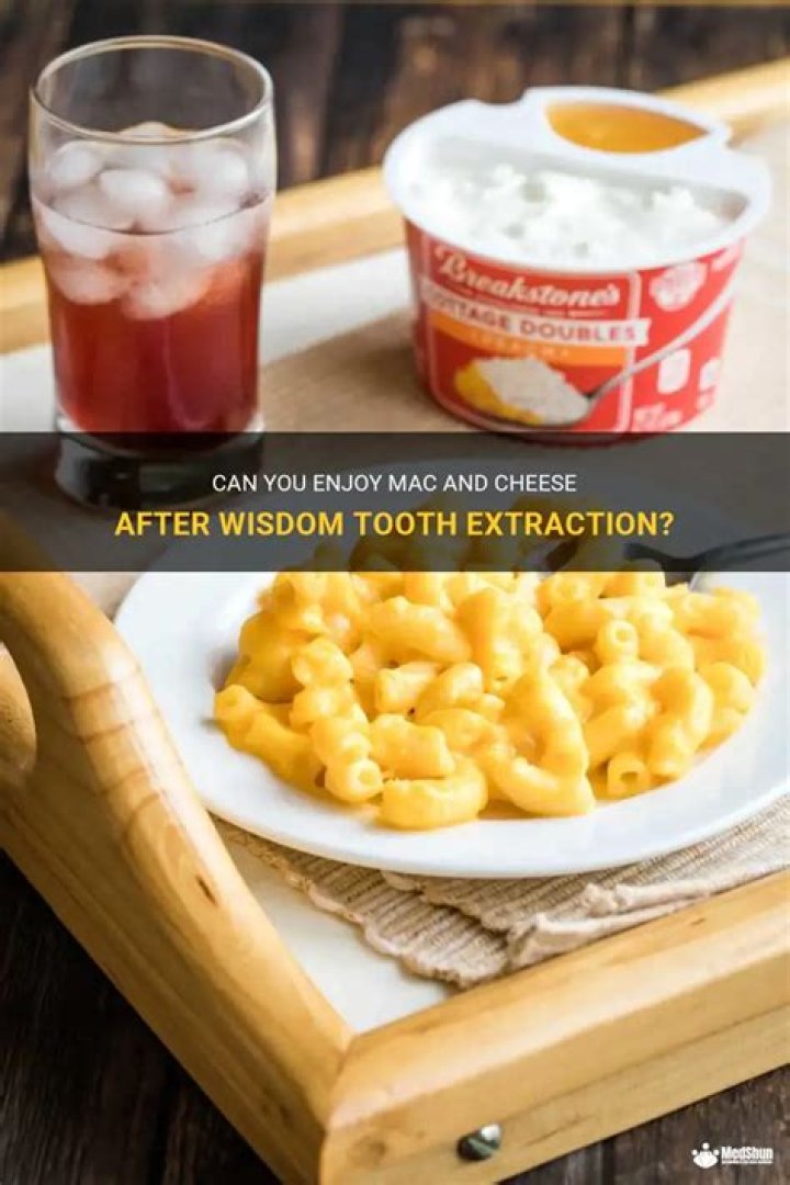 Can I eat mac and cheese after getting my wisdom teeth out?