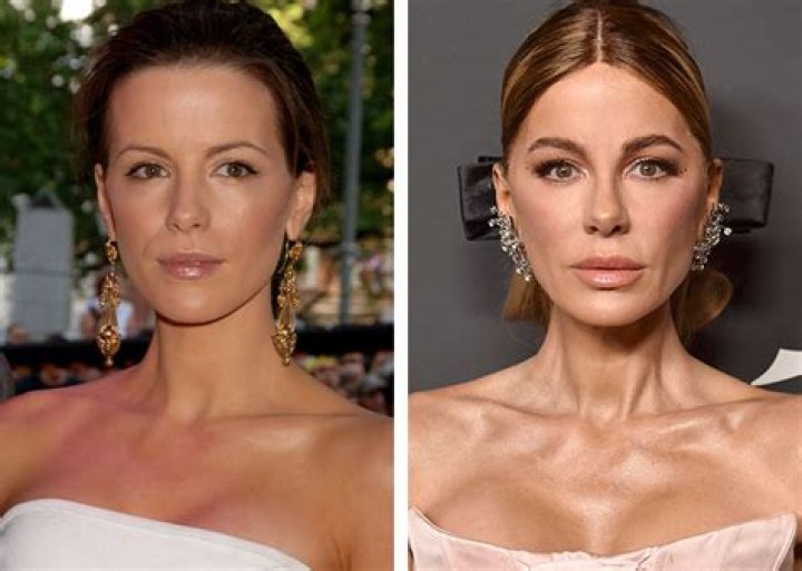 Celebrities Unrecognizable After Plastic Surgery