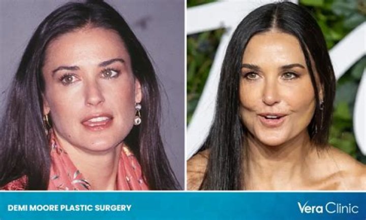Demi Moore denies plastic surgery: “The scalpel won’t make you happy”
