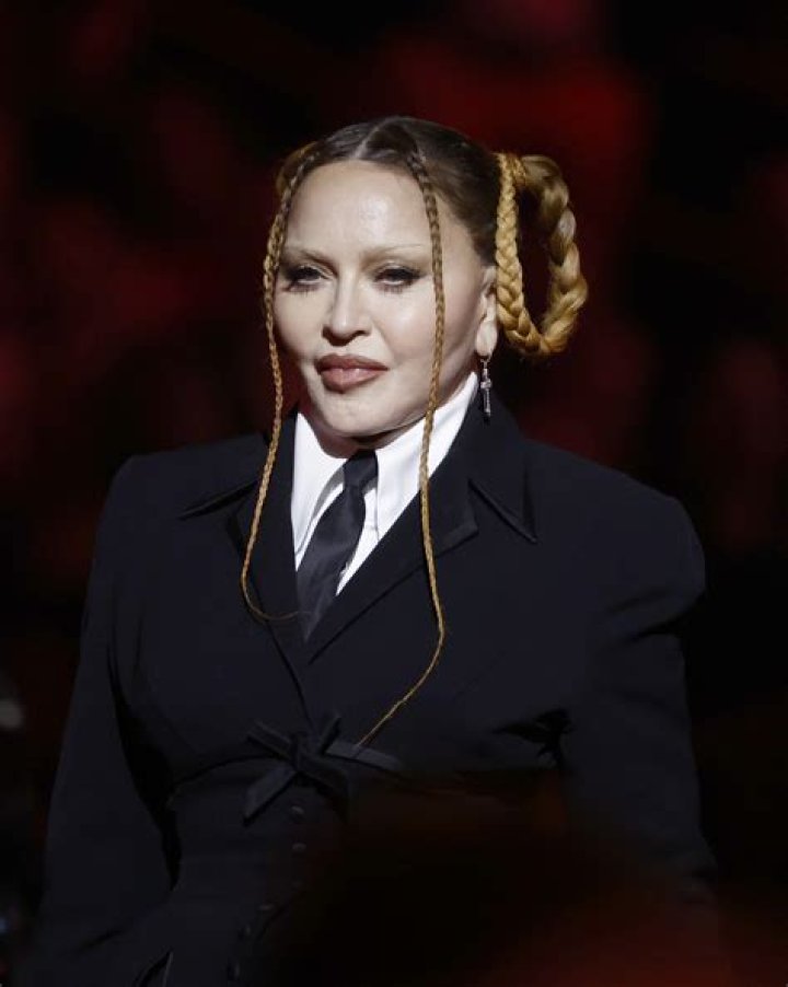 Did Madonna reduce the size of her chicken cutlet cheek implants?