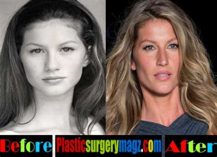 Gisele Bundchen admits she had breast augmentation in 2015 after breastfeeding