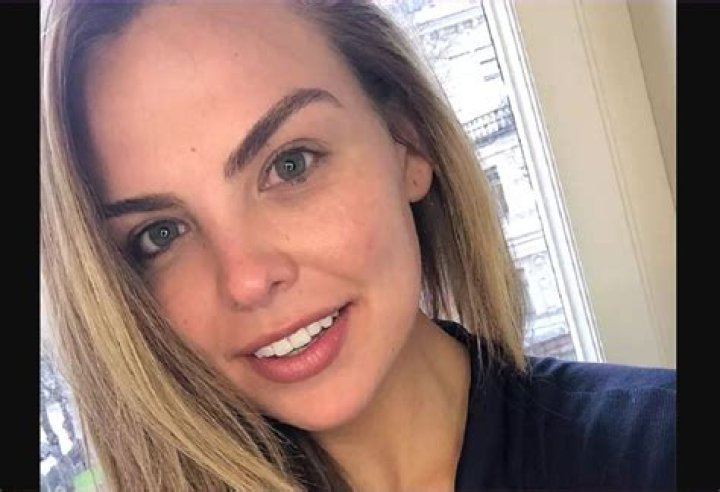 Hannah Brown Nose Job: Did She Get A Plastic Surgery?