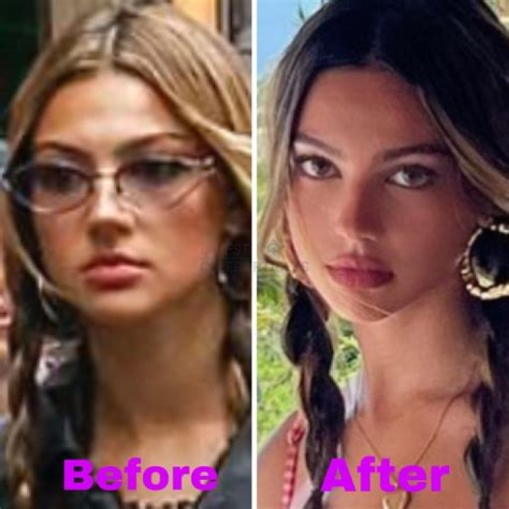 
Has Katarina Deme Done A Plastic Surgery? 