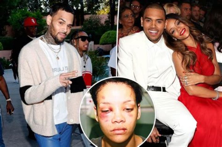 Horrific photo surfaces of Rihanna’s injuries from Chris Brown