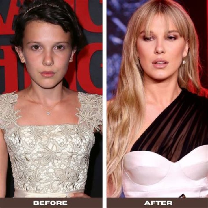 How Did Millie Bobby Brown Look Before And After Plastic Surgery?
