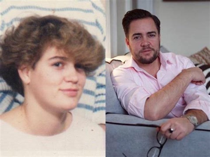 Ian Harvie Before Surgery And As A Child – Family And Wikipedia Bio