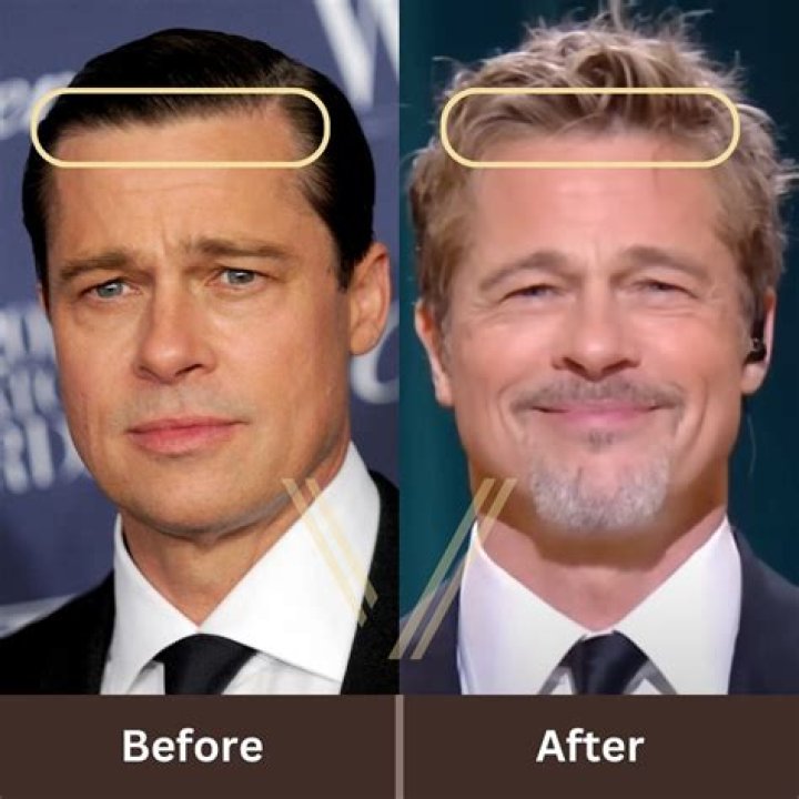 Is Brad Pitt wearing a toupee or some kind of hairpiece? An investigation.