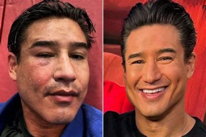 Is Mario Lopez Gay? Age, Height, Net Worth