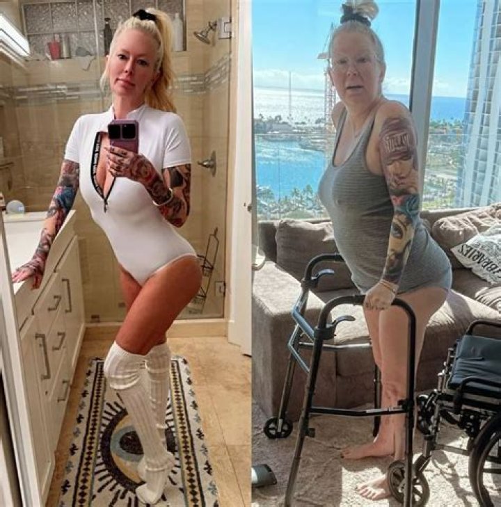Jenna Jameson removes her implants