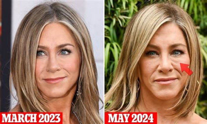 Jennifer Aniston: ‘Bad plastic surgery & injections can really kick you in the ass’