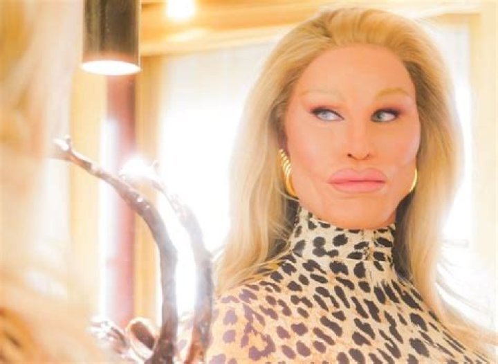 Jocelyn Wildenstein Before And After Plastic Surgery – Age And Husband