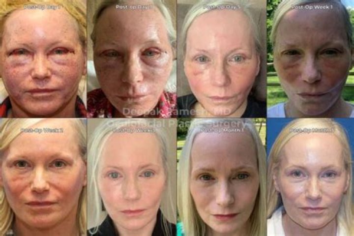 Judith Light Facelift Surgery: Are The Rumours True? Husband And Kids