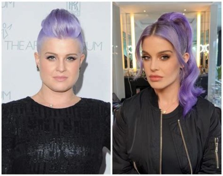 Kelly Osbourne denies she’s had plastic surgery other than ‘a couple of injections’