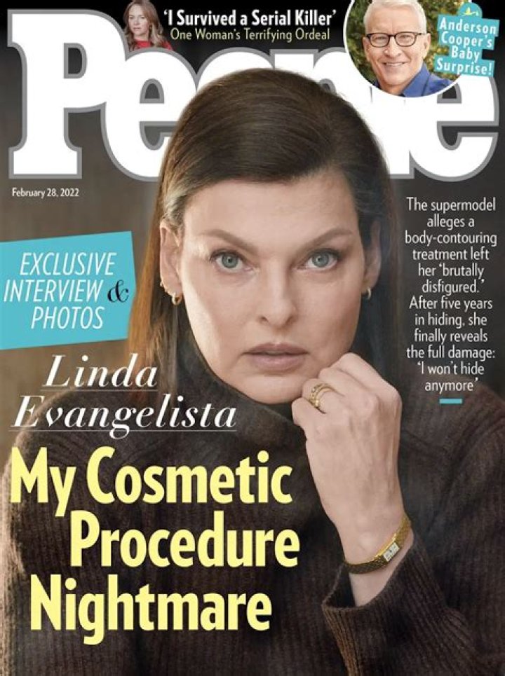 Linda Evangelista covers People: ‘I can’t live like this anymore, in hiding and shame’