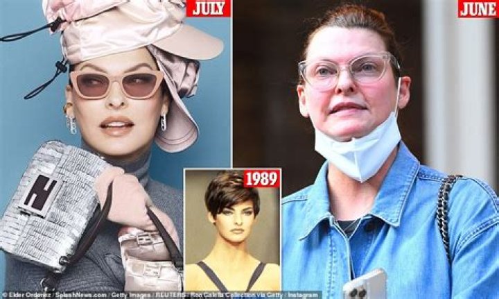 Linda Evangelista filed her $50 million lawsuit against CoolSculpting last week