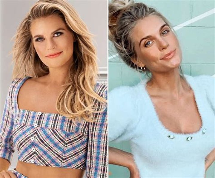 Madison Lecroy Lip Filler Surgery, Before And After Photos