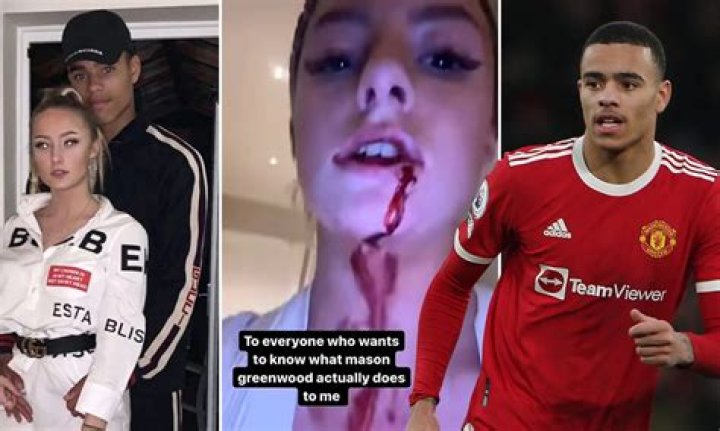Mason Greenwood Girlfriend Accuses Him Of Physical Violence With Pictures On IG
