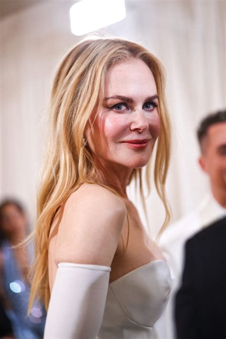Nicole Kidman looks especially frozen & what’s up with her boobs?
