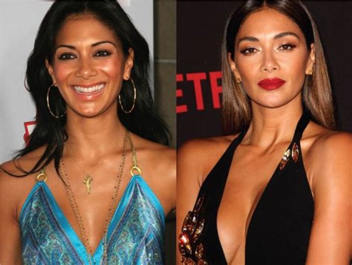 Nicole Scherzinger Nose Job Before And After Photos