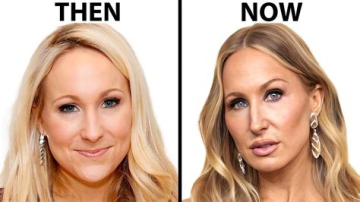 Nikki Glaser Plastic Surgery – Did She Get Her Lips Done? Before And After