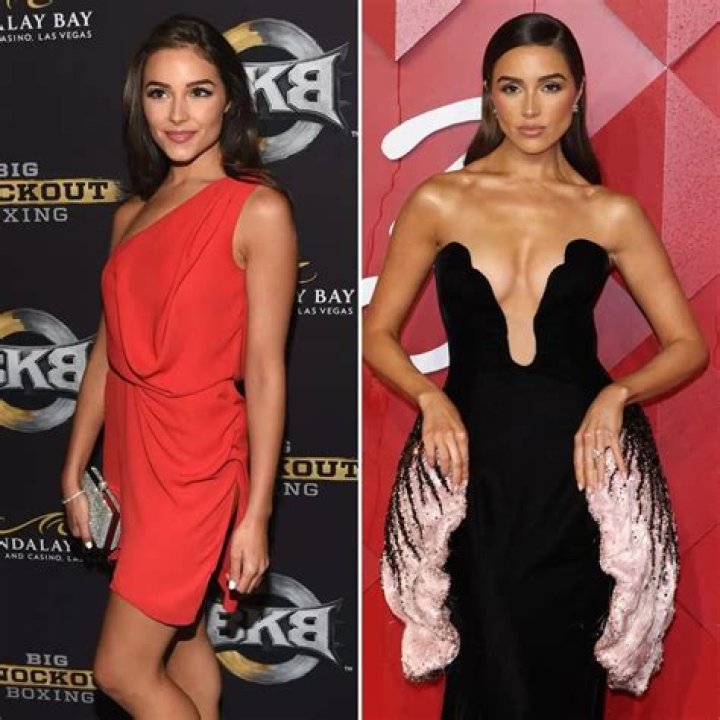 Olivia Culpo had surgery for her endometriosis: ‘I have been in agony for years’