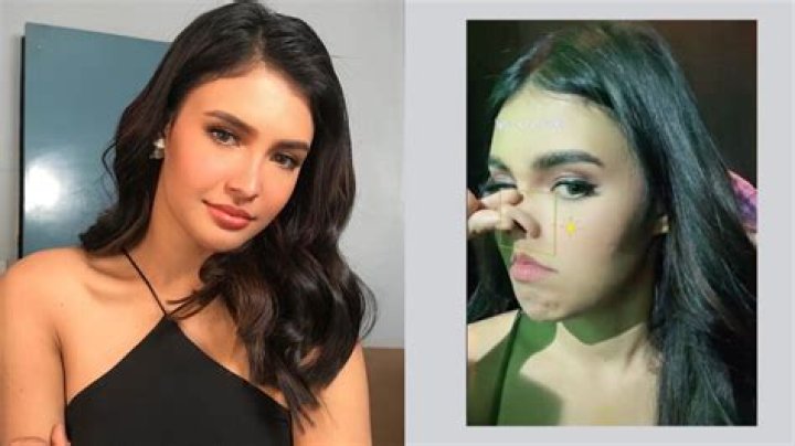 Rabiya Mateo Plastic Surgery: Before And After Photos