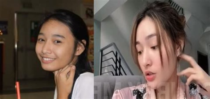 Sachzna Laparan Plastic Surgery Before And After: What Does She Look Like?