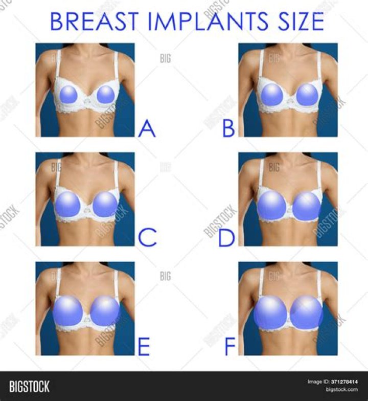 Star: Miley Cyrus “insists” on getting D-cup implants