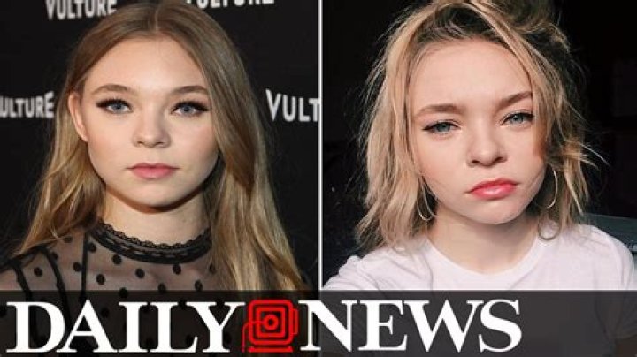 Taylor Hickson, 20, sues producers after suffering massive facial injuries on set