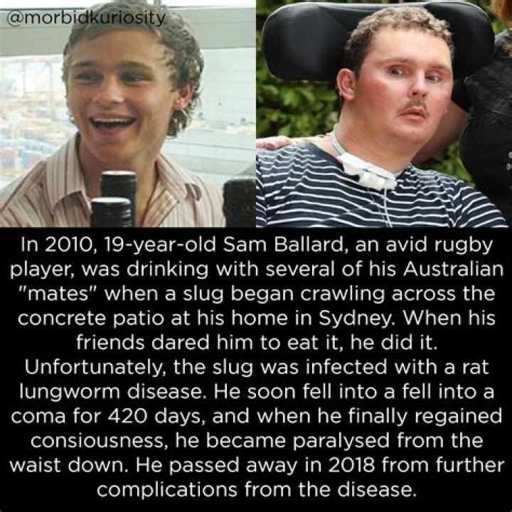 
The tragedy that befell rugby player Sam Ballard, who was killed by a slug, is discussed on Reddit. 