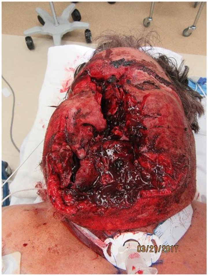 	Thomas Kingston died by ‘catastrophic wound’ to the head, with a gun nearby	