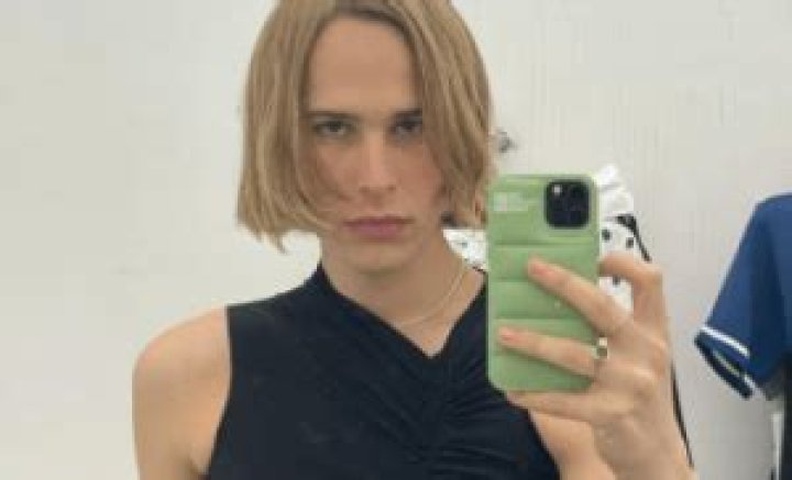 
Tommy Dorfman Before And After, Who is Tommy Dorfman? 