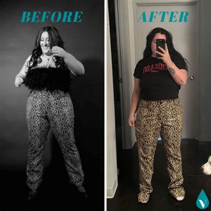 Weight Loss Before And After